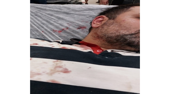 Büyükadadada gazeteci Güngör feci şekilde darp edildi! 